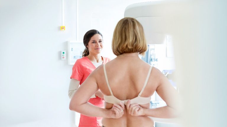 Mammografieën voor screening op borstkanker zouden op 40-jarige leeftijd moeten beginnen, en niet op 50-jarige leeftijd, zegt de regeringstaakgroep