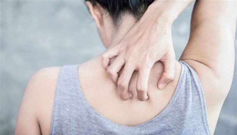Herpes Zoster, wie loopt er risico en hoe kan dit worden voorkomen?