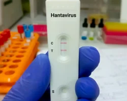 Hantavirus, hoe lang zullen de waarschuwingen, voorzorgsmaatregelen en twijfels over asymptomatische mensen duren