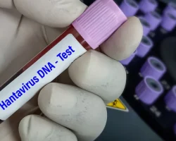 Hantavirus, risico’s, maskers, quarantaine: de indicaties van het ministerie van Volksgezondheid
