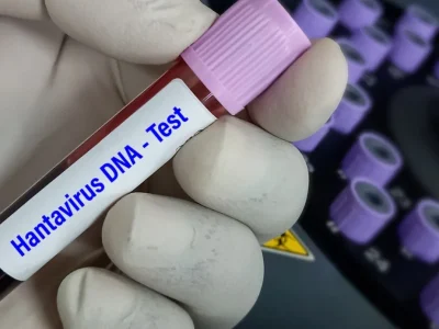 Hantavirus, risico’s, maskers, quarantaine: de indicaties van het ministerie van Volksgezondheid