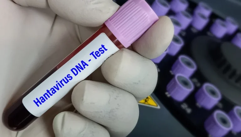 Hantavirus, risico’s, maskers, quarantaine: de indicaties van het ministerie van Volksgezondheid