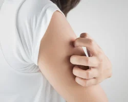 Chronische jeuk, als het om Prurigo Nodularis gaat, hoe herken je het en hoe ga je ermee om?