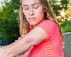 Dengue, Chikungunya en meer: ​​wat arbovirussen zijn, waarom ze toenemen en wat het klimaat ermee te maken heeft