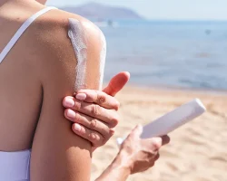 Uitdroging, gezwollen benen, huiduitslag en meer: ​​wat moet je meenemen tegen zomerkwaaltjes