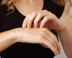 Dermatofilose of regenziekte, waarom het ook mensen kan treffen, hoe het zich manifesteert en hoe ermee omgegaan wordt
