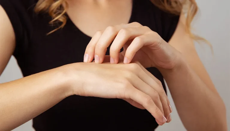 Dermatofilose of regenziekte, waarom het ook mensen kan treffen, hoe het zich manifesteert en hoe ermee omgegaan wordt