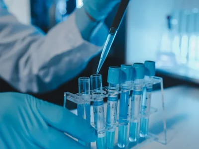 Het Shamonda-virus, wat het is, hoe het wordt overgedragen, wat u moet weten