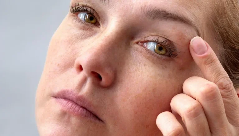 Het virale ‘low iron face’ op Tik Tok, de symptomen en wat er achter de trend zit